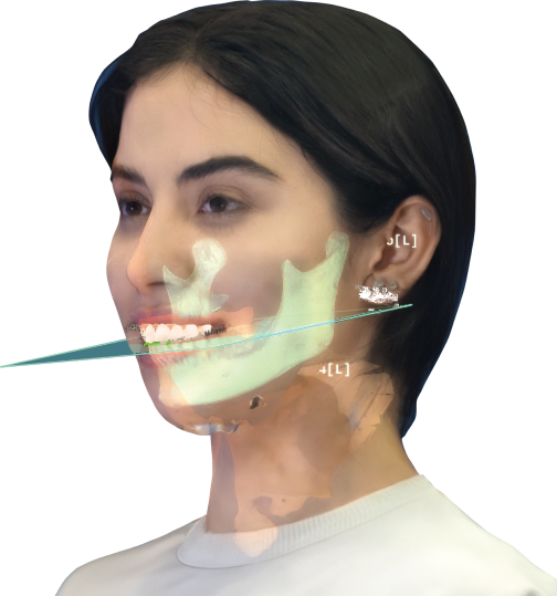 Tracking Markers - 12